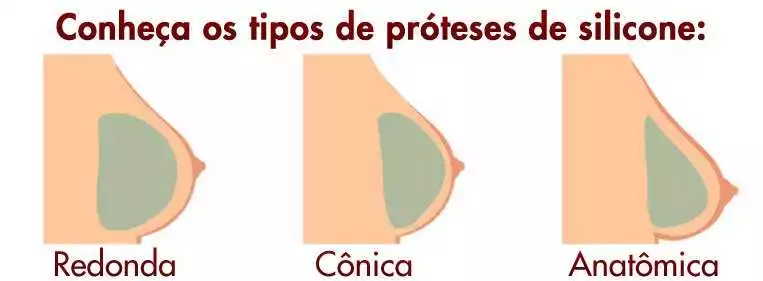 Próteses de Silicone